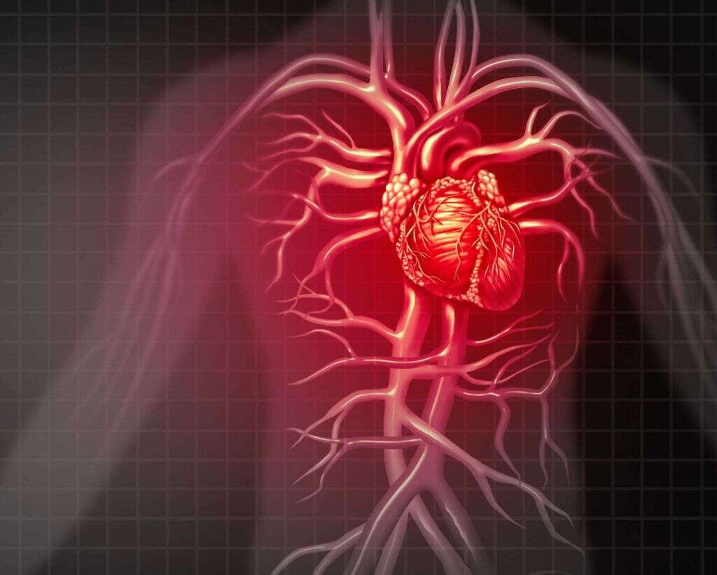 Dyslipidemia
