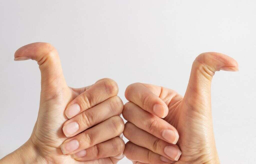 EDS Disease