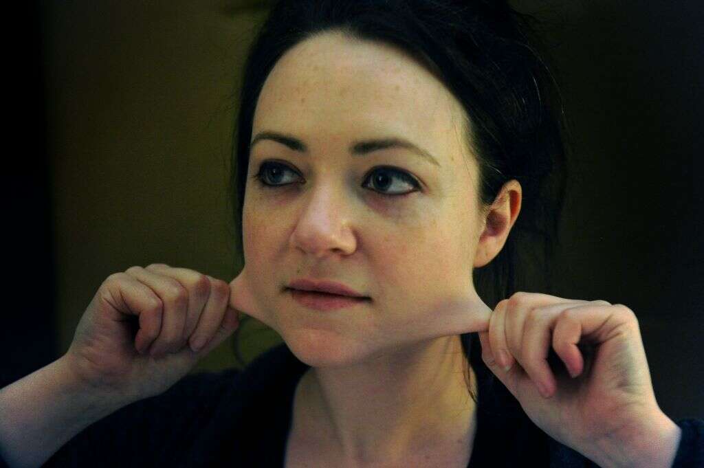 Ehlers Danlos