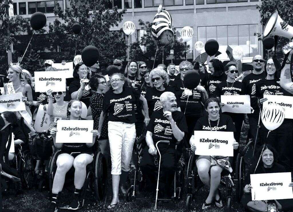 Ehlers Danlos Syndrome