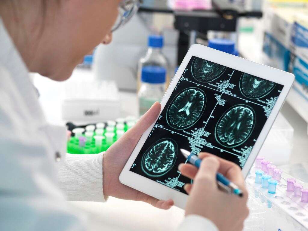 Empty Sella Syndrome