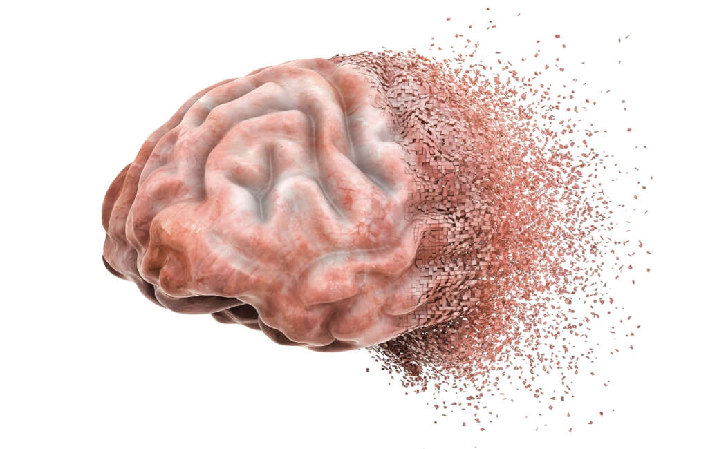 Encephalitis