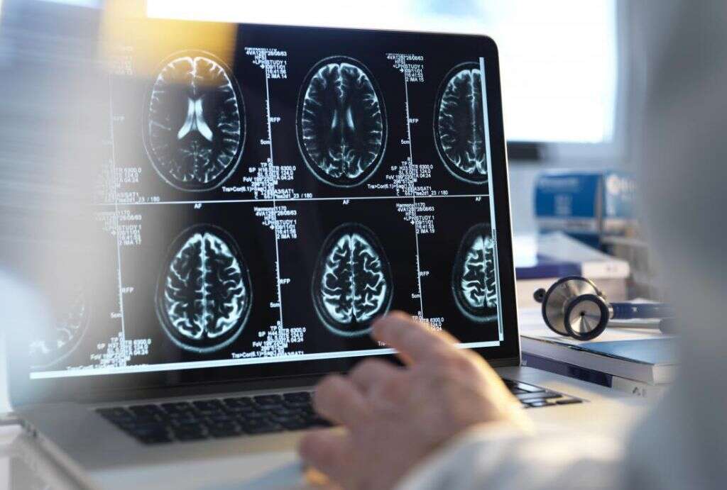 Encephalopathy