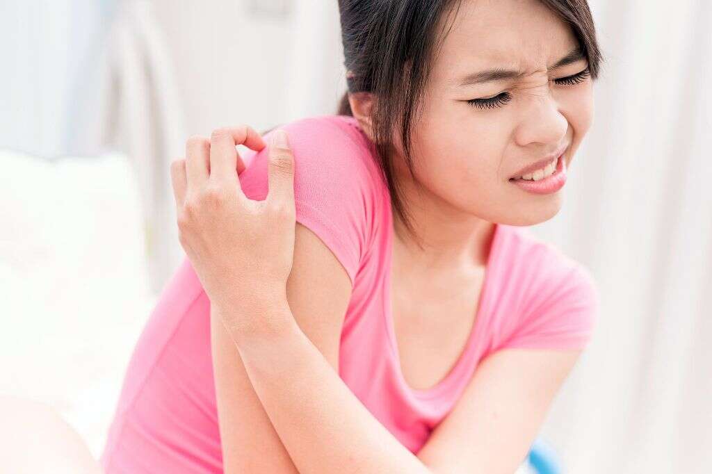 Erythema Multiforme