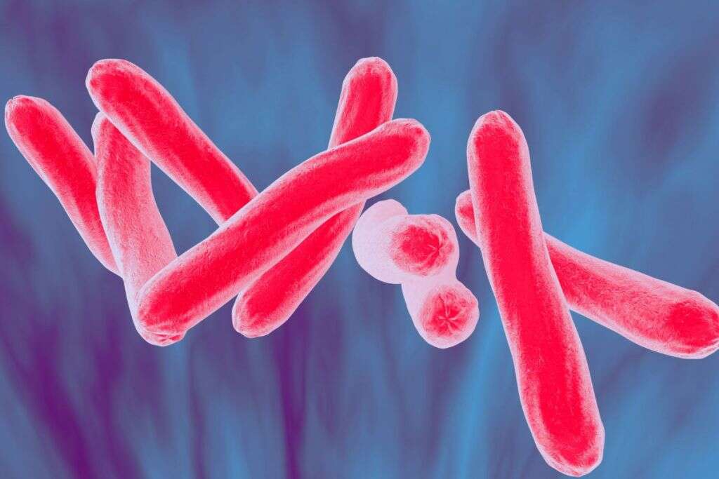 Erythema Nodosum