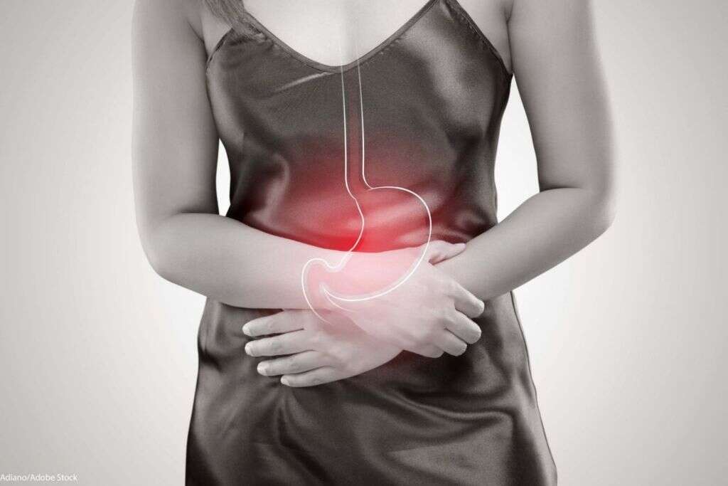 Esophageal Cancer