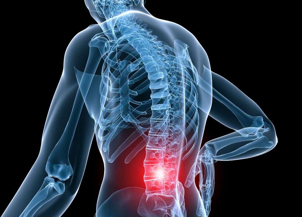 Facet Arthropathy