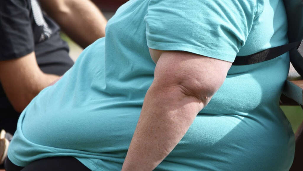 Fatty Liver Disease