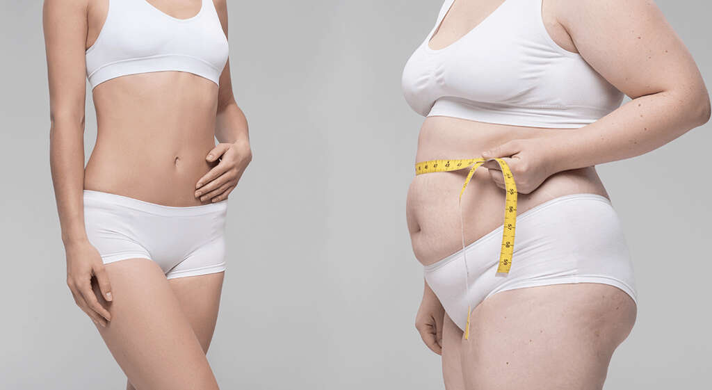 Fatty Liver Disease