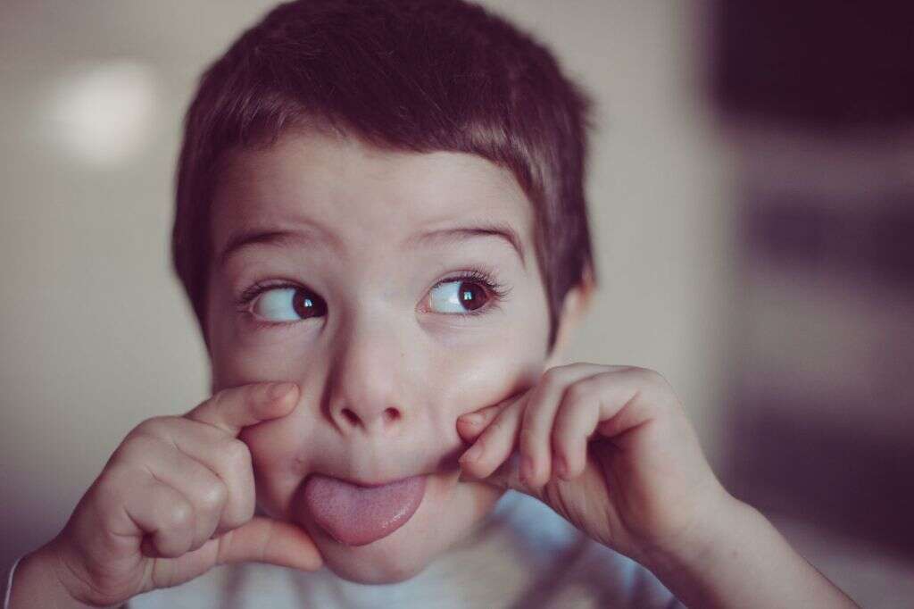 Fissured Tongue