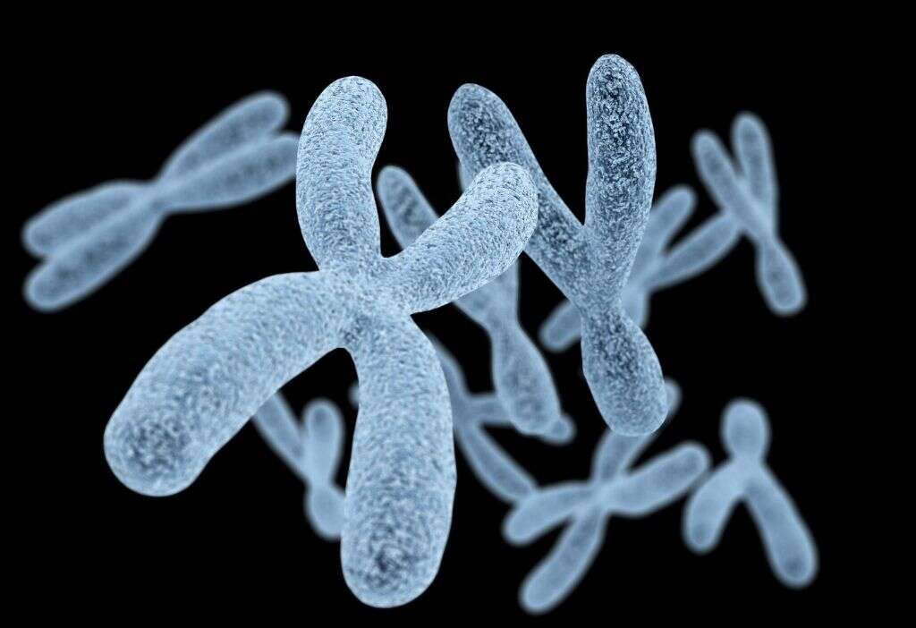 Fragile X Syndrome