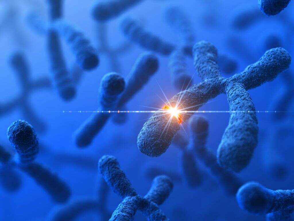 Fragile X Syndrome