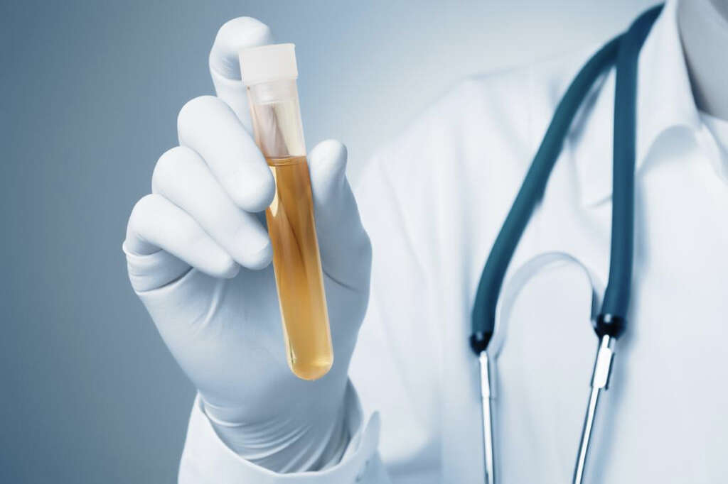 Galactosemia