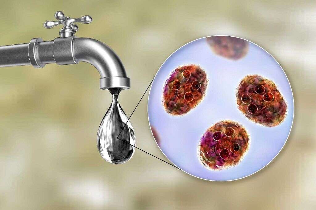 Giardiasis