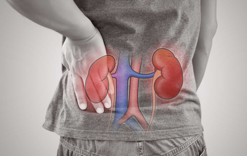 Glomerulonephritis