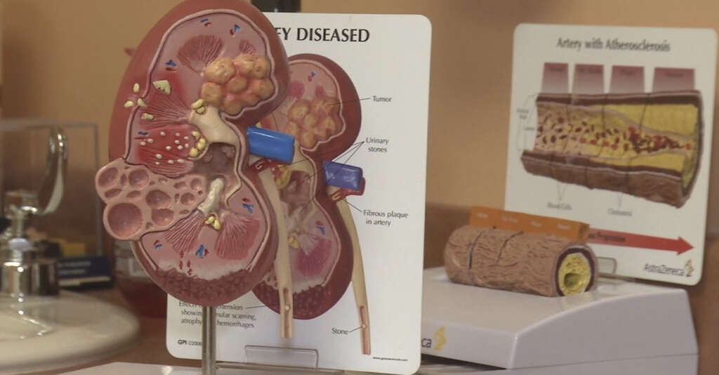 Glomerulonephritis