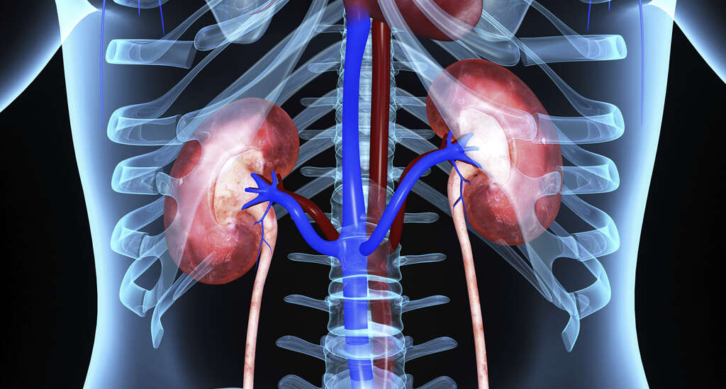 Glomerulonephritis
