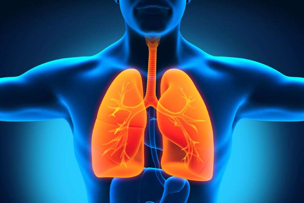 Goodpasture Syndrome