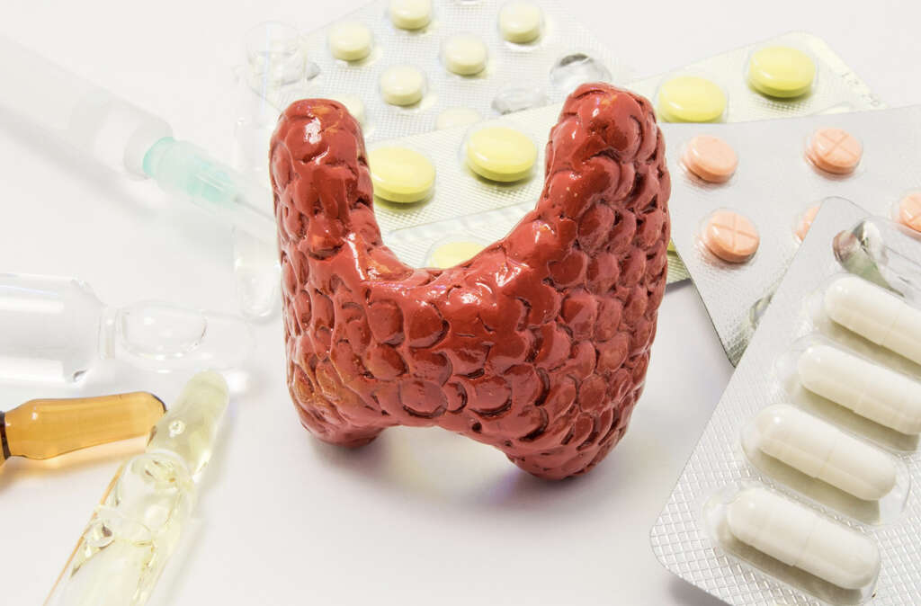 Graves Disease