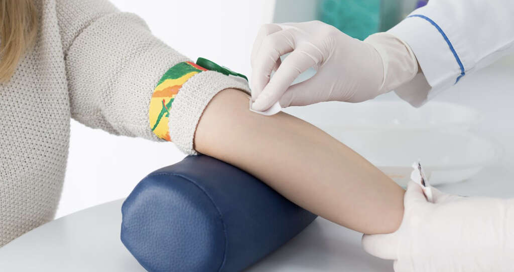 Graves Disease