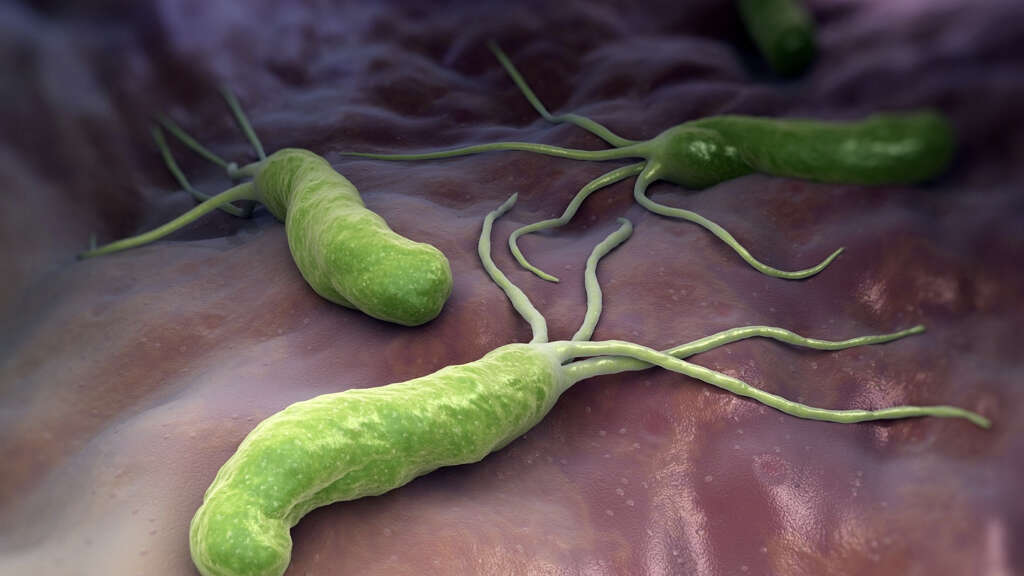 H. Pylori