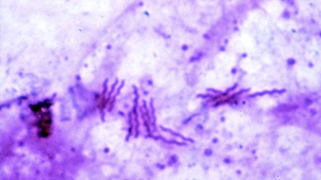 H. Pylori