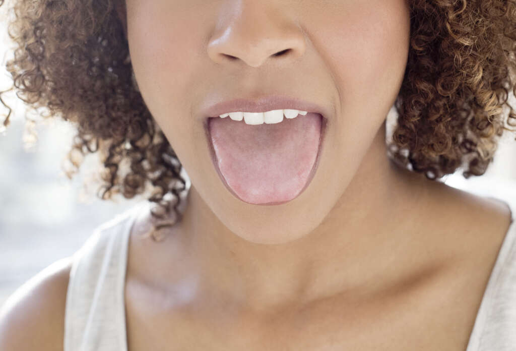 Hairy Tongue