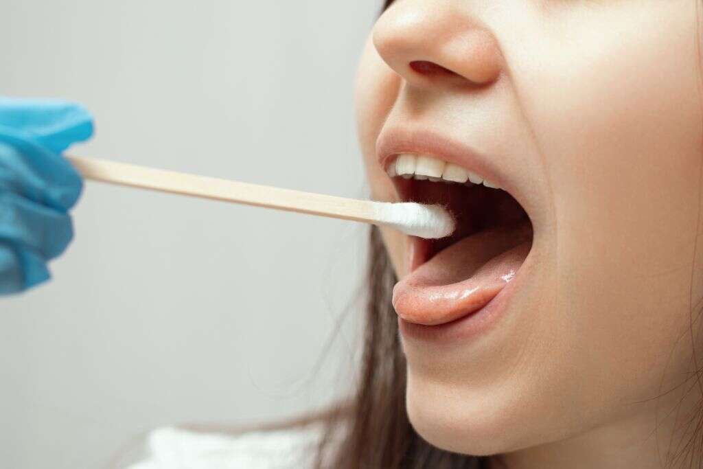 HFMD