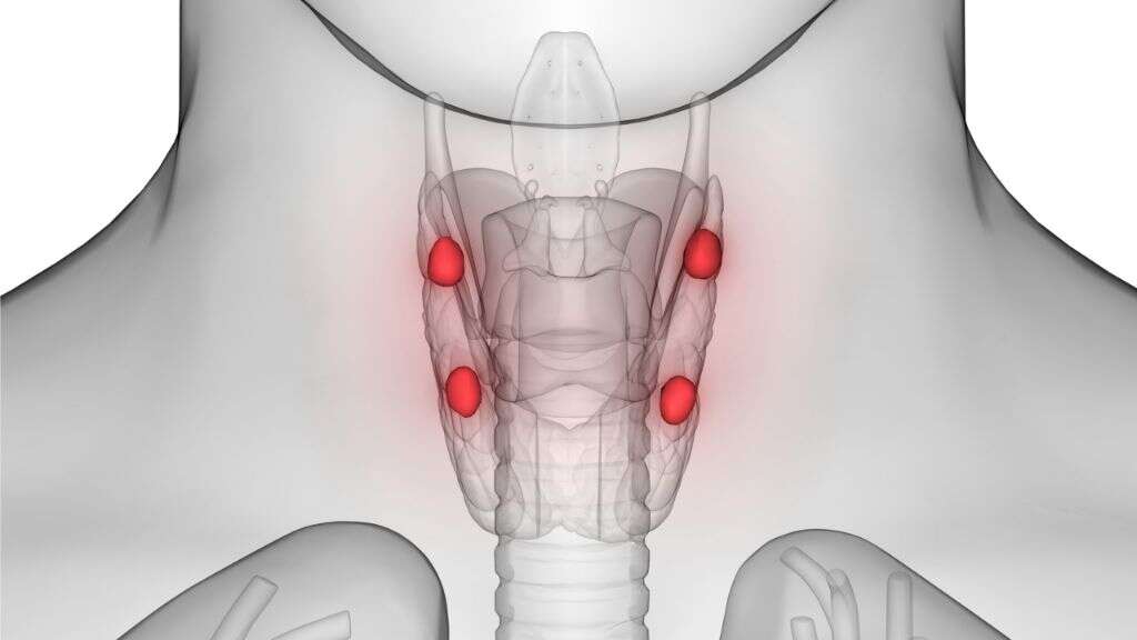 Hypercalcemia