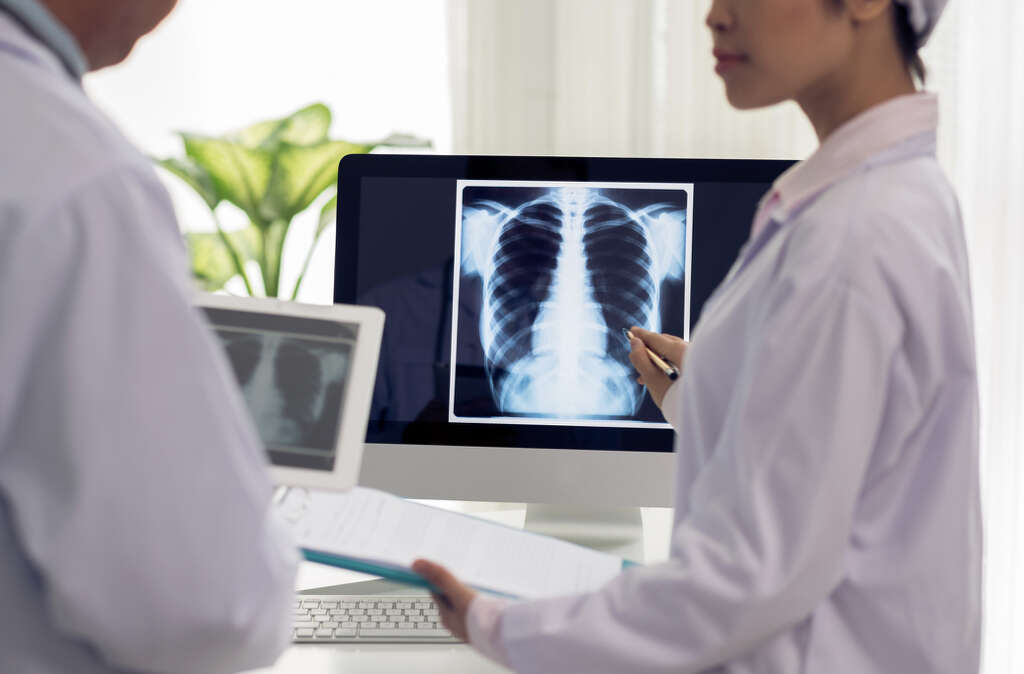 Hypersensitivity Pneumonitis