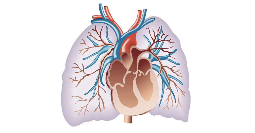 Hypersensitivity Pneumonitis