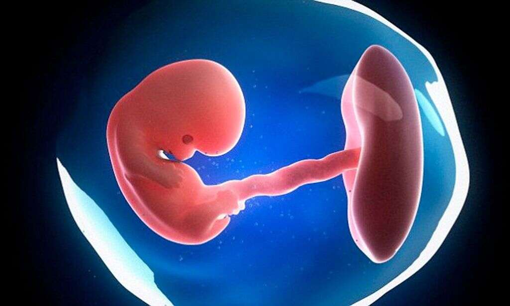 Hypophosphatasia