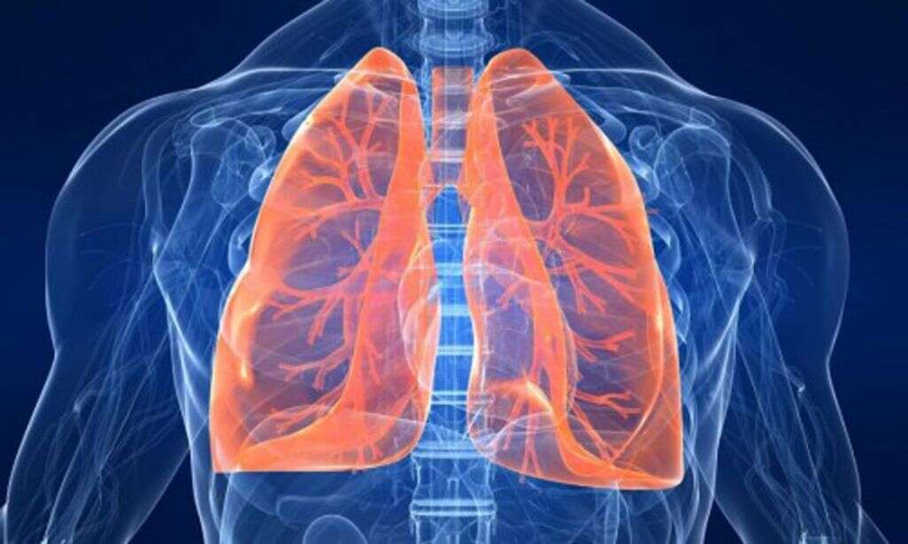 Influenza A
