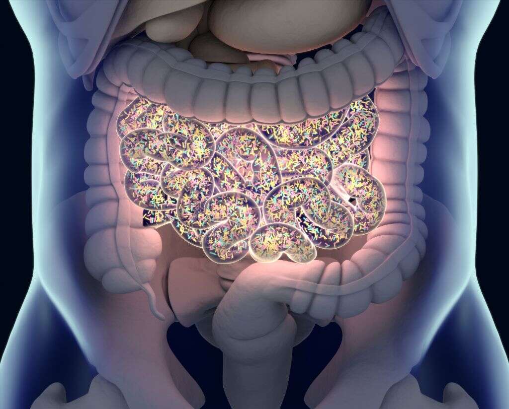 Irritable Bowel Syndrome