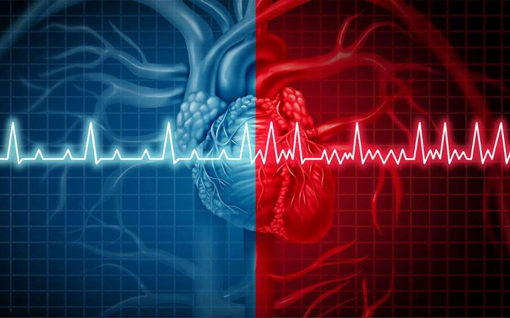 Ischemia