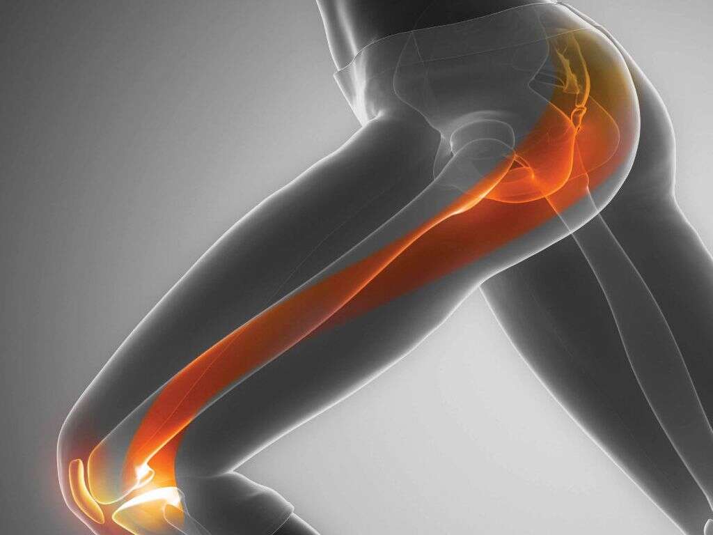 Iliotibial Band Syndrome: Iliotibial Band Syndrome Symptoms