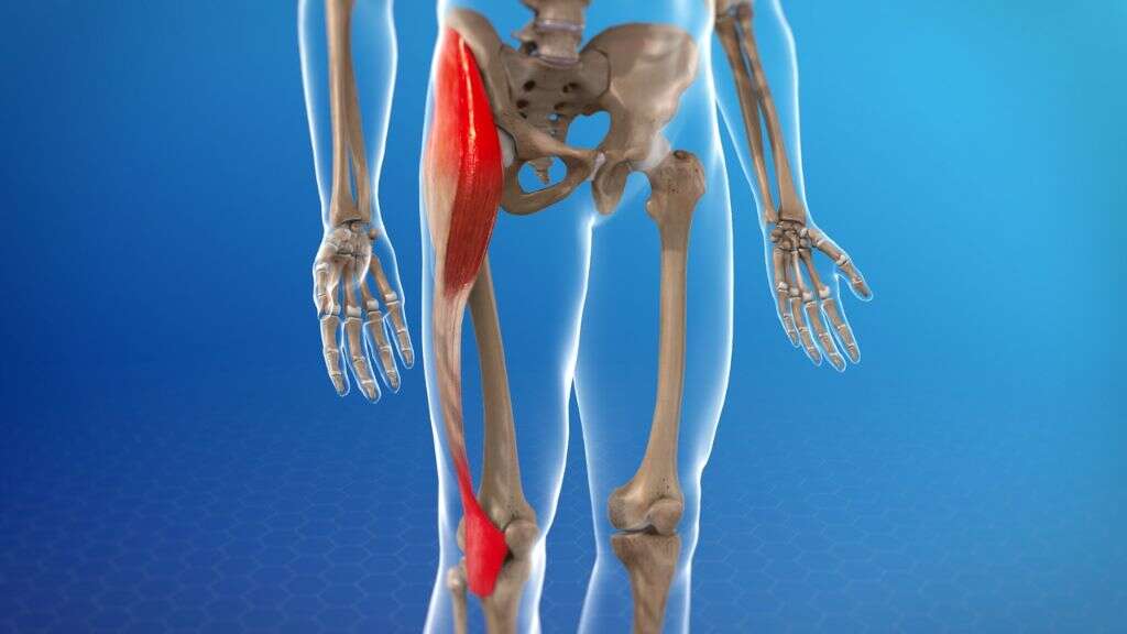 IT Band Syndrome