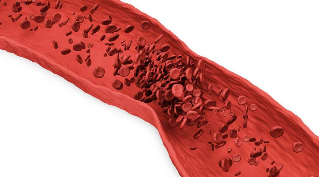 Kidney Disease
