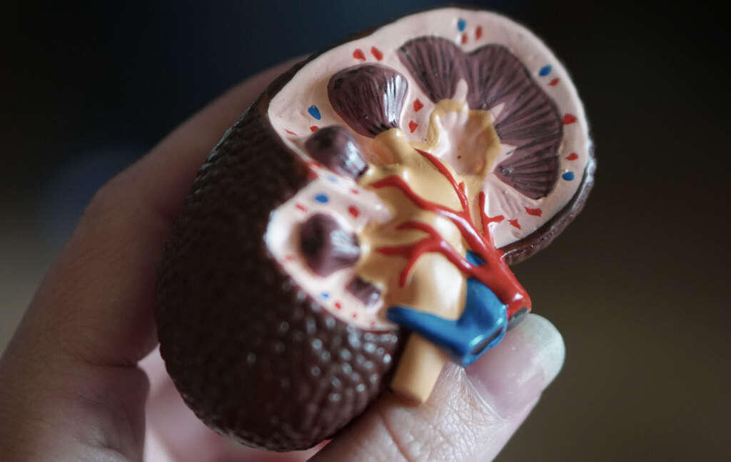Kidney Failure