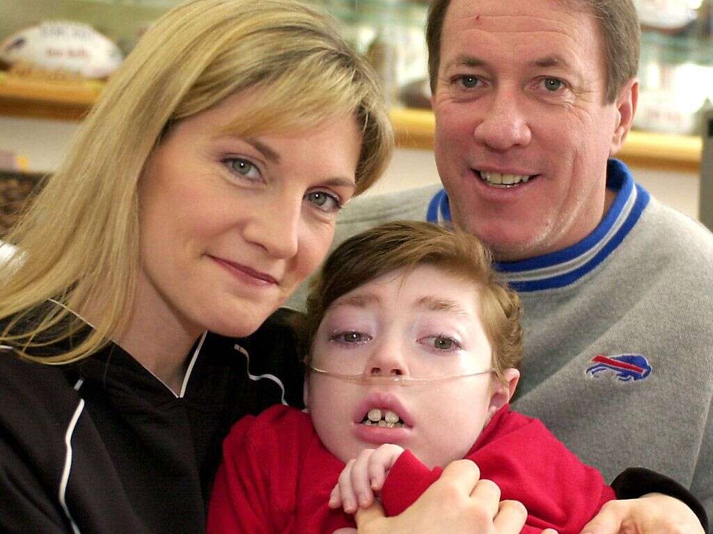 Krabbe Disease