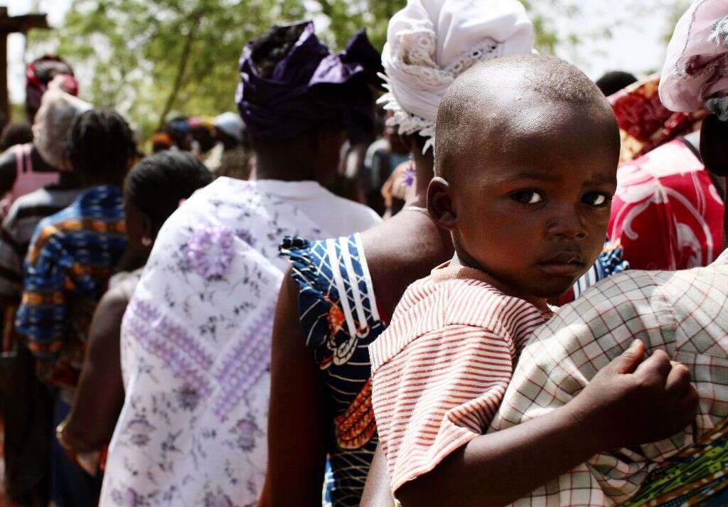 Kwashiorkor