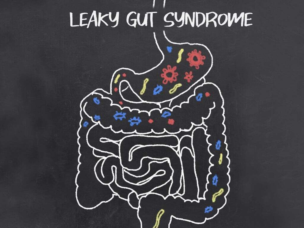 Leaky Gut Syndrome