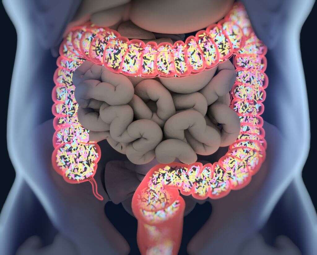 Leaky Gut Syndrome