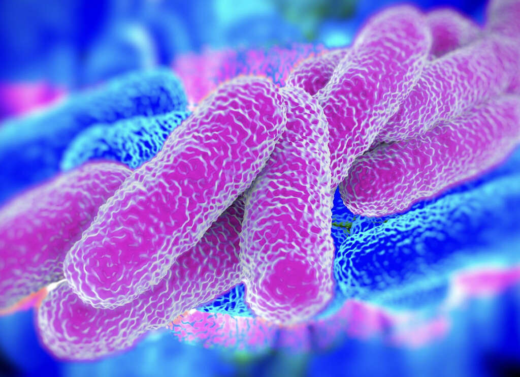 Legionnaires Disease