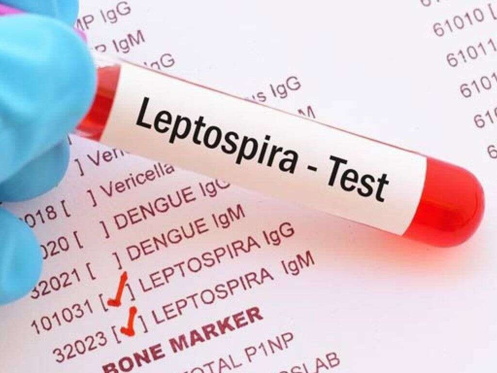 Leptospirosis