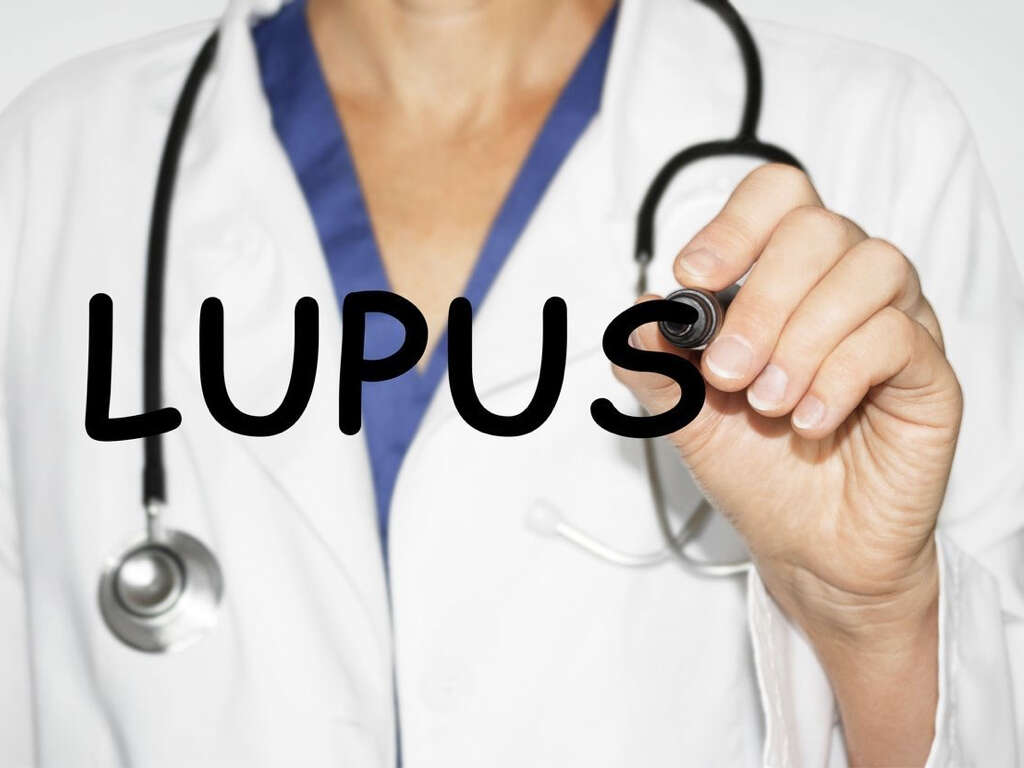 Lupus