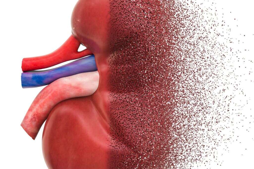 Meningitis