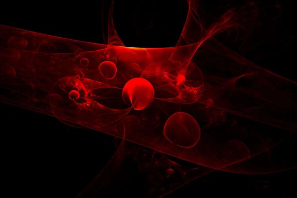 Microcytic Anemia