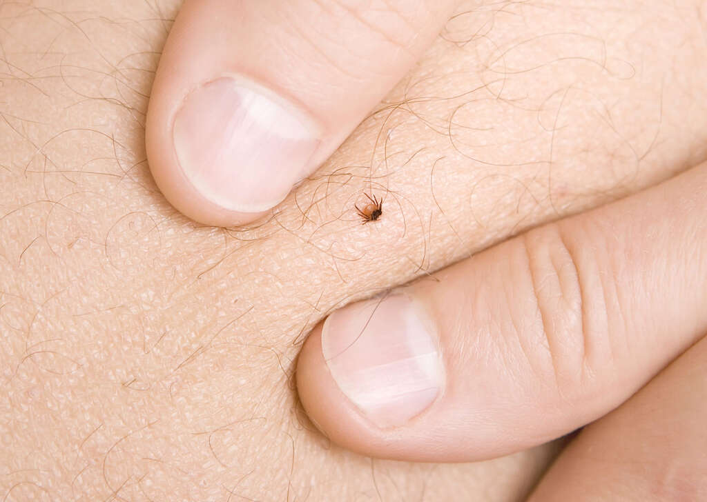 Morgellons