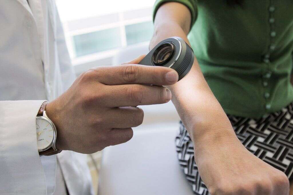 Morphea